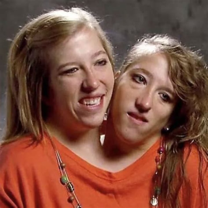 Abby And Brittany Hensel: Sad News 2024