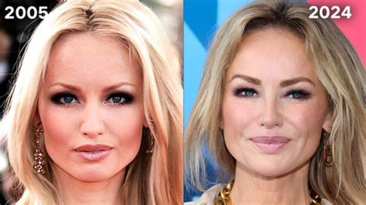 Adriana Karembeu Chirurgie