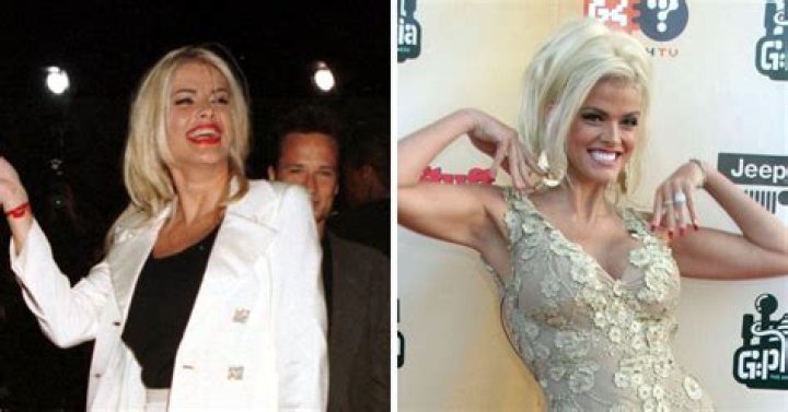 Anna Nicole Smith Before Plastic Surgery: The Untold Truth!