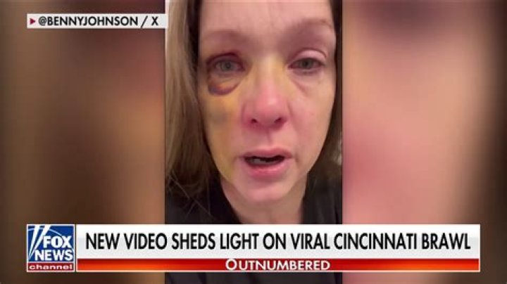Beating victim blindsided once again | Free News