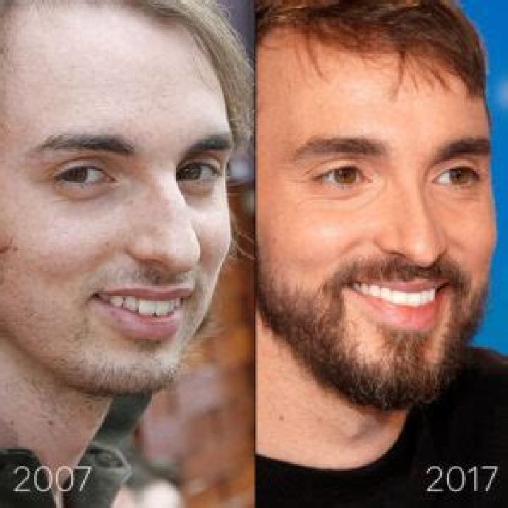 Christophe Willem Chirurgie