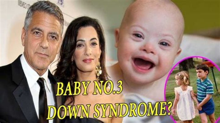 Does George Clooney's Son Have Down Syndrome? Understanding The Truth Behind The Rumors