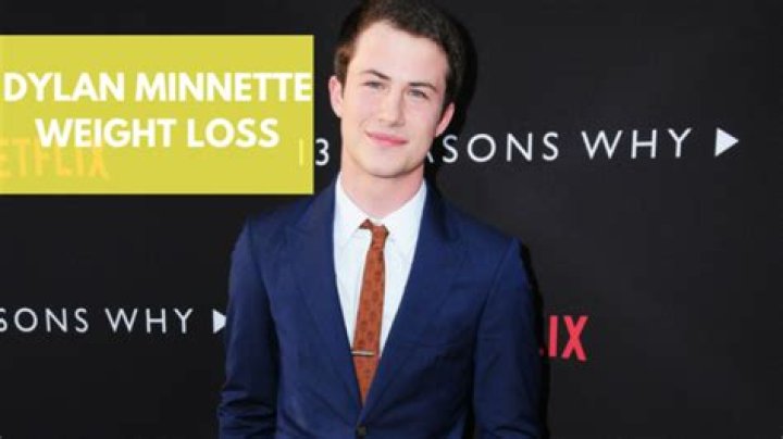 Dylan Minnette Slams Weight Loss Fanatics On Twitter