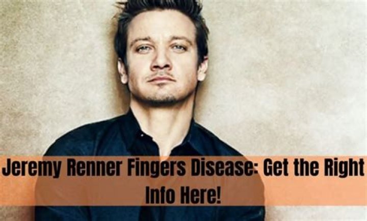 Exploring The Fascinating Story Behind Jeremy Renner's Fingers