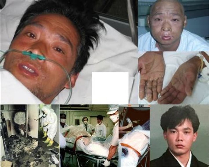 Exploring The Life And Legacy Of Hisashi Ouchi: A Fatal Accident In Nuclear History