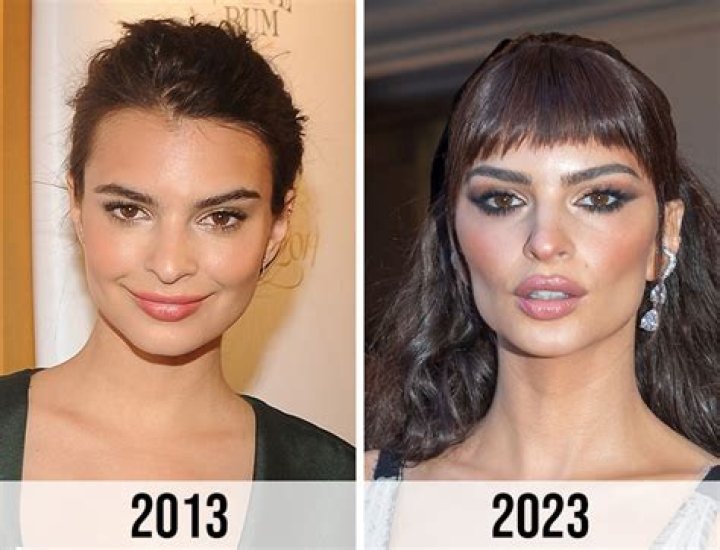 Exploring The Truth Behind Emily Ratajkowski's Implants