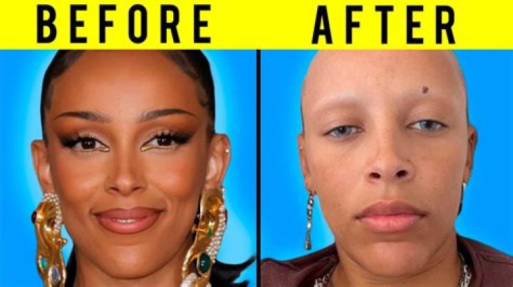 Exploring The Unique Beauty Of Actresses With Scars Between Their Eyebrows