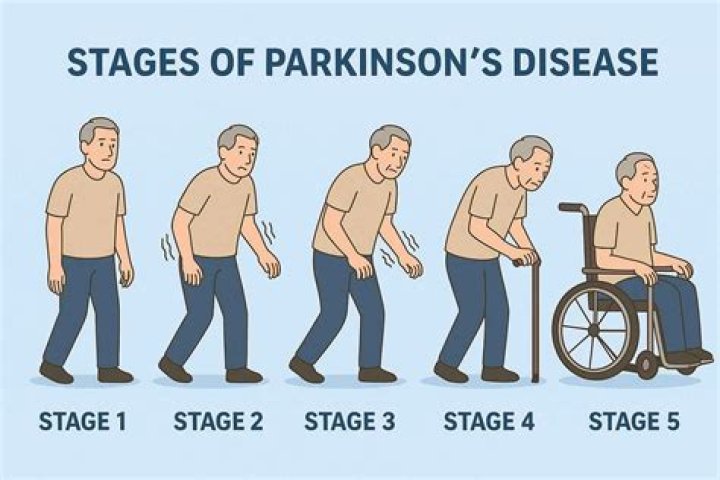 Facing The Challenge: Roger Cook And His Journey With Parkinson's Disease