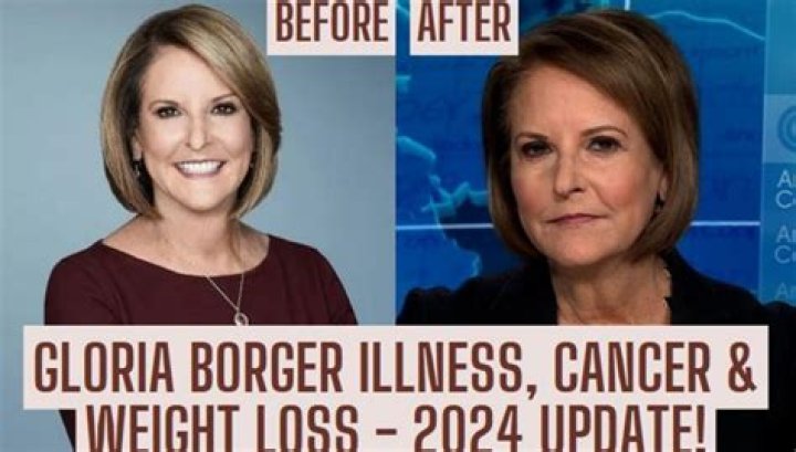 Gloria Borger Weight Loss: A Journey To Health And Wellness