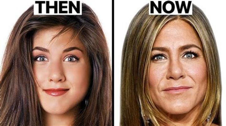 Has Jennifer Aniston Had Plastic Surgery