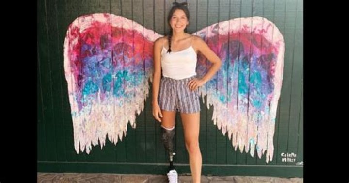 How Did Alaqua Cox Lose Her Leg? A Journey Of Strength And Resilience