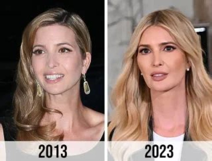 Ivanka Trump’s Plastic Surgery — Her Before And After Photos