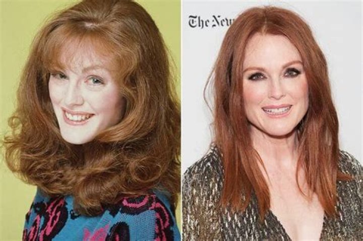 Julianne Moore Plastic Surgery: Truth Behind The Transformation