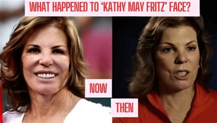 Kathy May Fritz: A Comprehensive Biography Of An Inspirational Figure