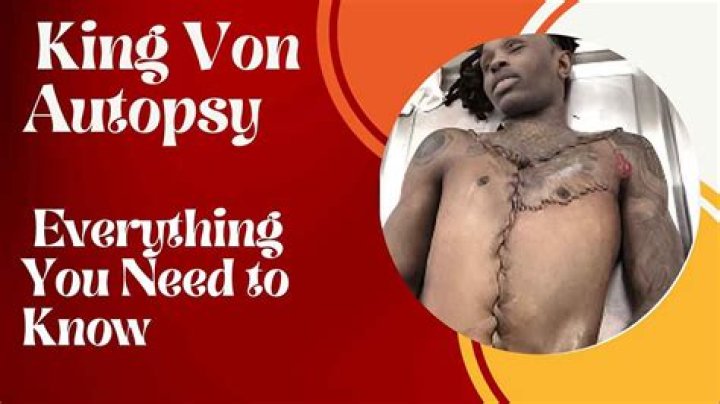 King Von Autopsy: A Deep Dive Into The Life And Legacy Of A Fallen Star