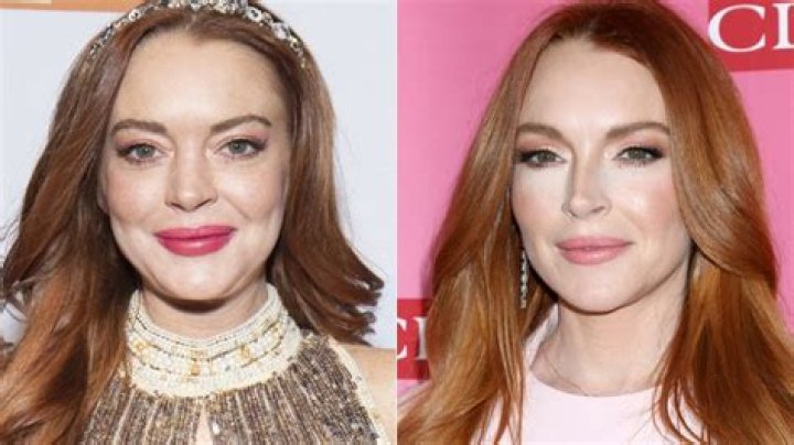 Lindsay Lohan's Plastic Surgery: Uncovering The Truth Behind The Headlines