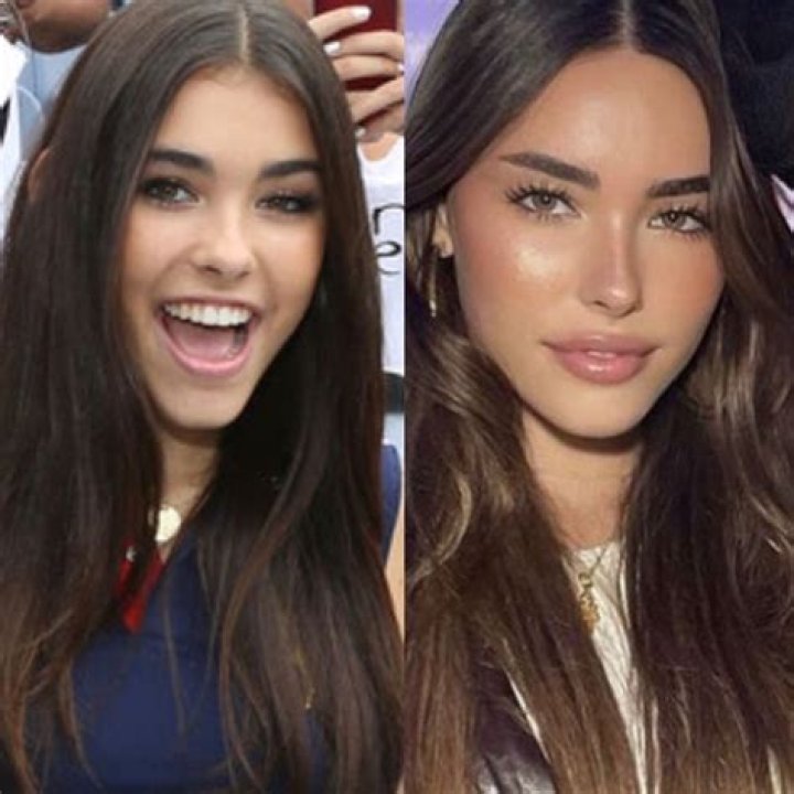 Madison Beer shows “proof” she didn’t have plastic surgery after rumors