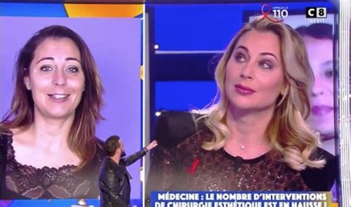 Magalie Berdah Chirurgie, Avant Apres 