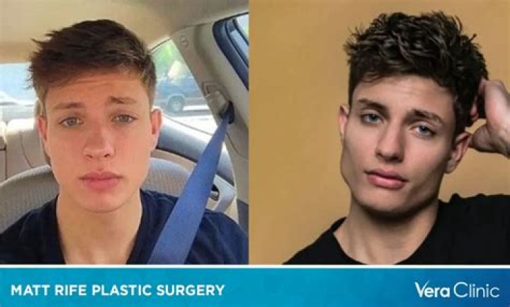 Matt Rife: The Rising Star And His Sexuality Controversy