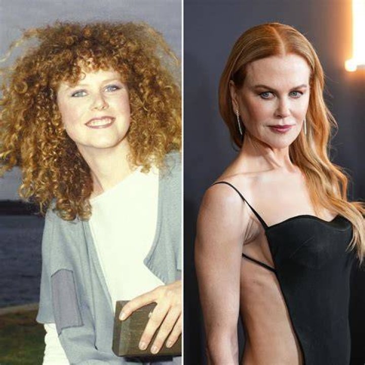 Nicole Kidman Plastic Surgery: The Truth Behind Her Ageless Beauty
