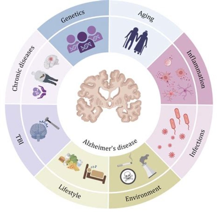 Pfizer ends neuroscience discovery programme, including research into Alzheimer’s disease treatment – Alzheimer’s Society comment