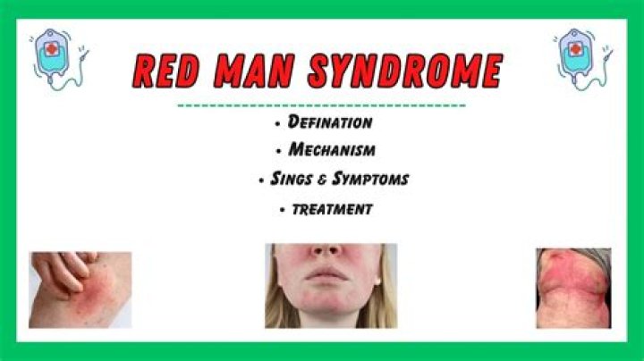 Redman's Illness: Health Status, Diagnosis, And Impact