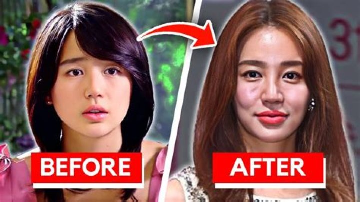 SEO Ye-Ji Before Surgery: A Comprehensive Look At Her Transformation