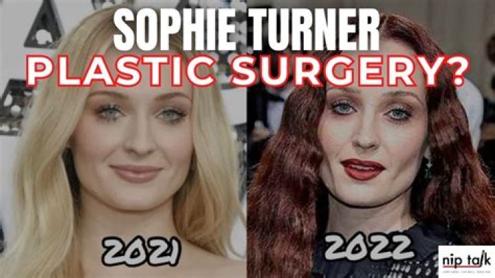 Sophie Rain Plastic Surgery: Everything You Need To Know
