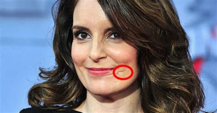 The Story Behind Tina Fey’s Scar on Her Face