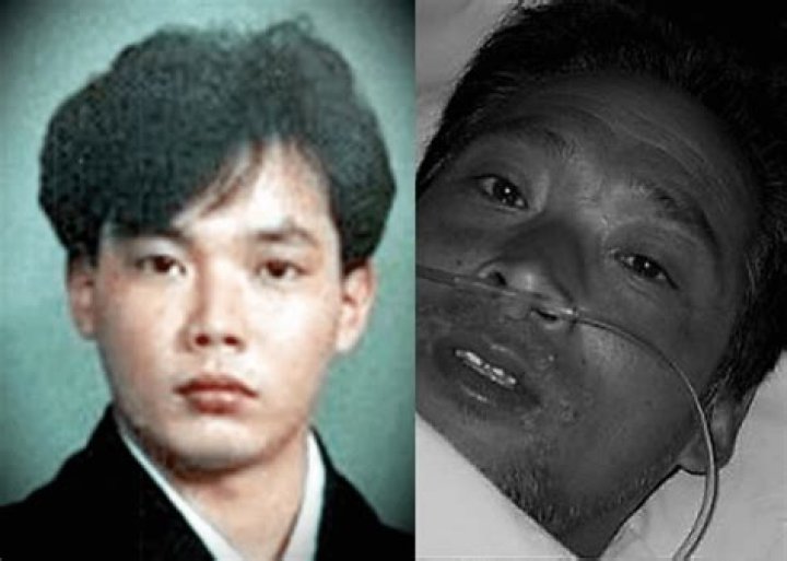 The Tragic Tale Of Hisashi Ouchi: A Case Study Of Human Resilience