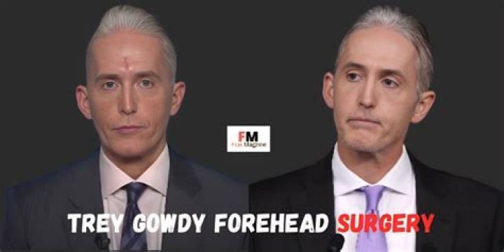 Trey Gowdy Forehead Surgery: The Truth Behind The Transformation