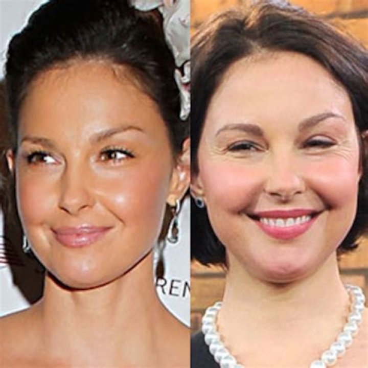 Truth About Ashley Judd's Face Accident And Plastic Surgery