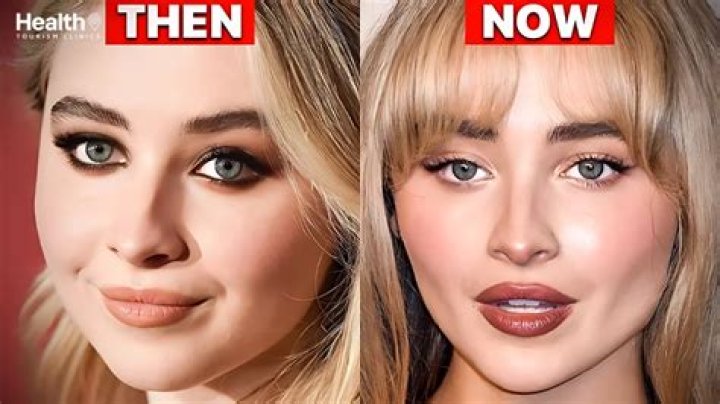 Truth Behind Sabrina Carpenter's Plastic Surgery Rumors