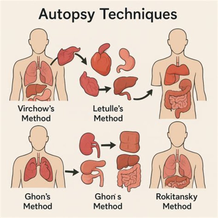 Understanding Dee Dee's Autopsy: A Detailed Examination