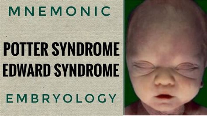 Understanding Edward Bluemel Syndrome: An In-Depth Exploration