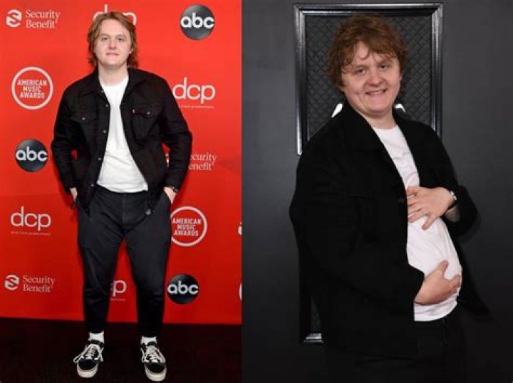 Understanding Lewis Capaldi's Weight Gain: A Journey Through Personal Struggles And Triumphs