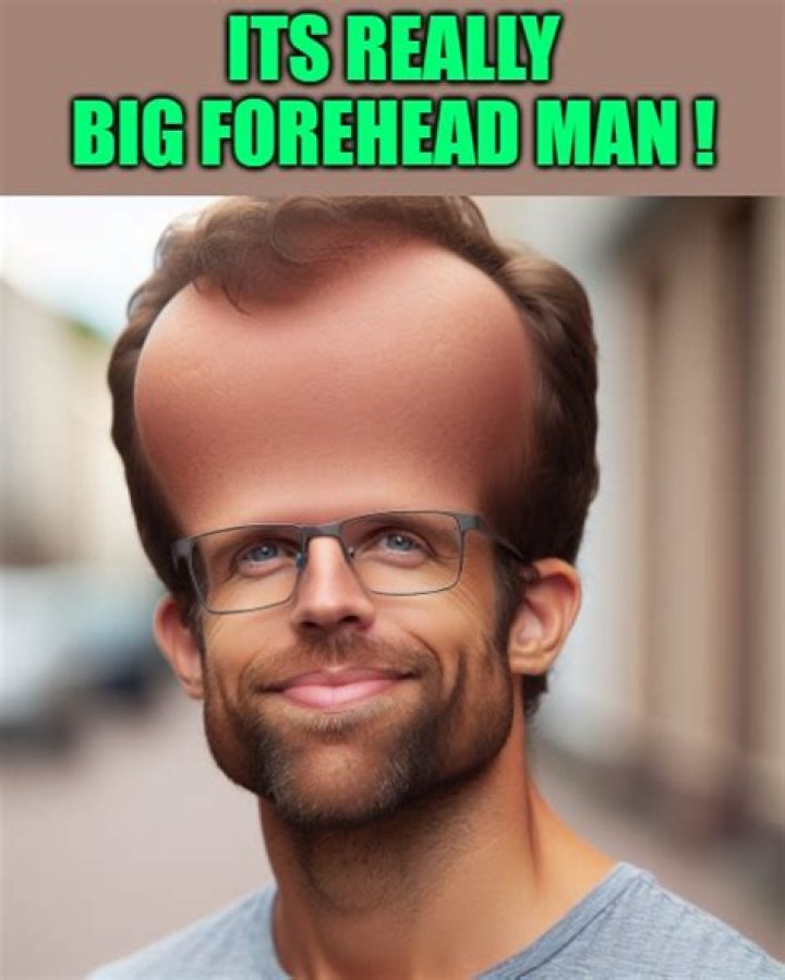 Understanding The Huge Forehead Meme: Its Origins, Impact, And Evolution