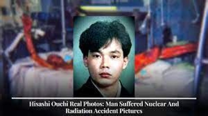Unveiling The Enigma Of Hisashi Ouchi's Skin