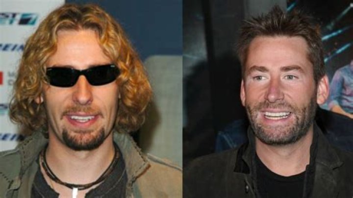 Unveiling The Mystery Behind Chad Kroeger's Surgery