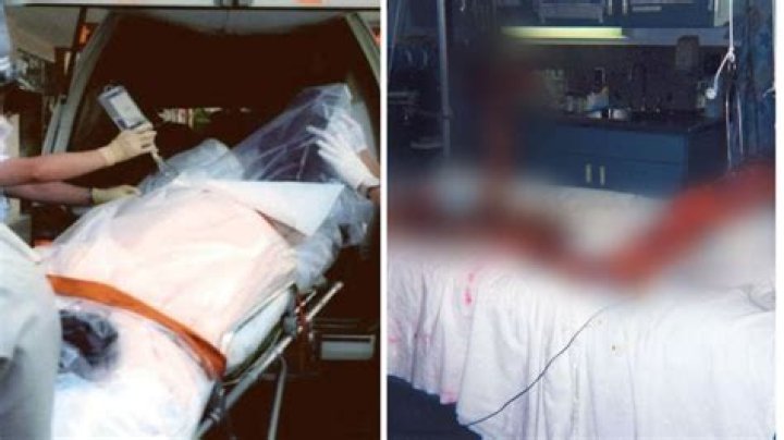 Unveiling The Tragic Story Behind Hisashi Ouchi’s Radiation Photo