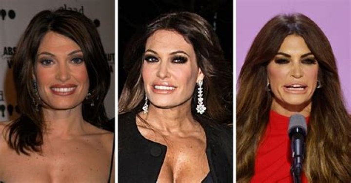 Unveiling The Transformation: Kimberly Guilfoyle Plastic Surgery 2024