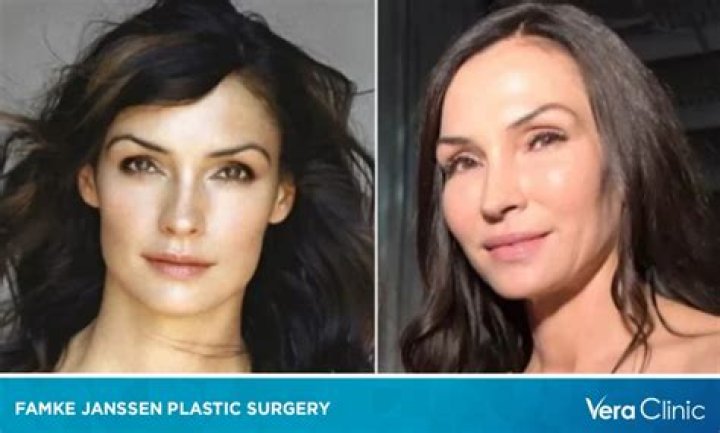 Unveiling The Truth Behind Famke Janssen's Surgery: A Journey Through Change