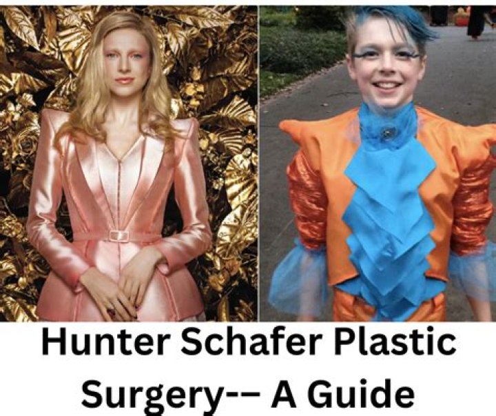 Unveiling The Truth: Did Hunter Schafer Have Surgery?