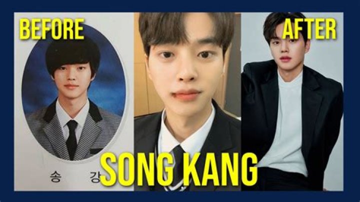 Unveiling The Truth: Song Kang Plastic Surgery