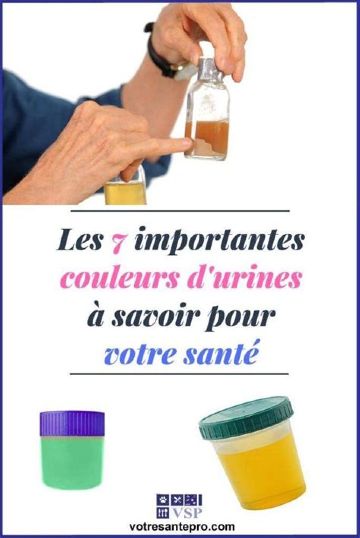 Urine Orange Foncé Chez La Femme