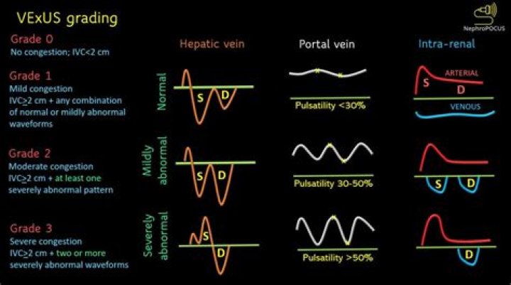 VPL vs. VXUS – A Comprehensive Comparison