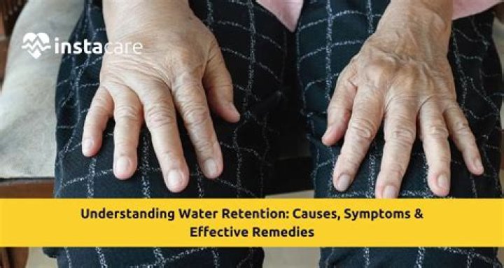 Water Retention | Causes, Symptoms, Remedies