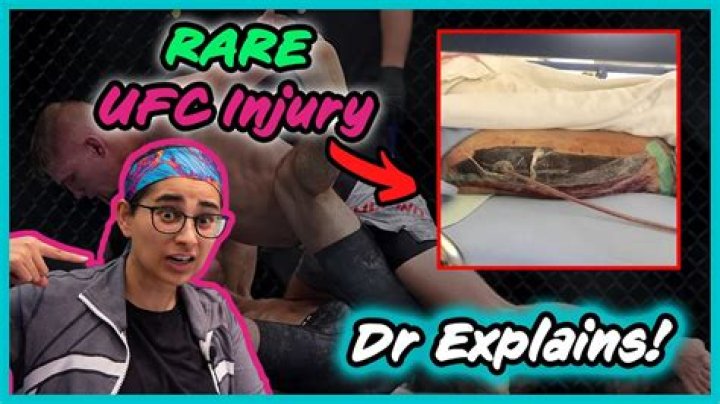What happened to Austin Hubbard's leg? Explaining compartment syndrome suffered by UFC 292 fighter