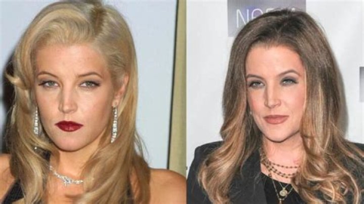 What Plastic Surgery Did Lisa Marie Presley Have? Find Out