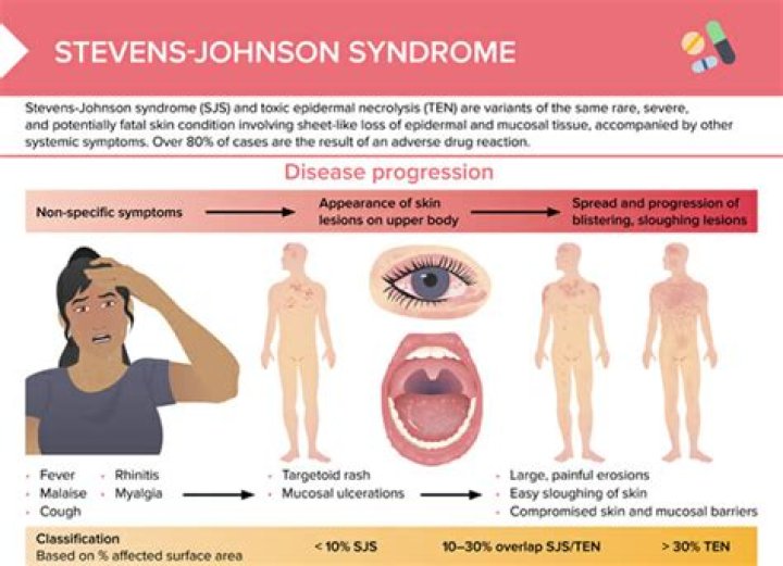 What You Need To Know About Stevens Johnson Syndrome Litigation